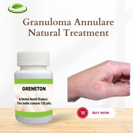 Most Effective Treatments for Granuloma Annulare A Comprehensive Review